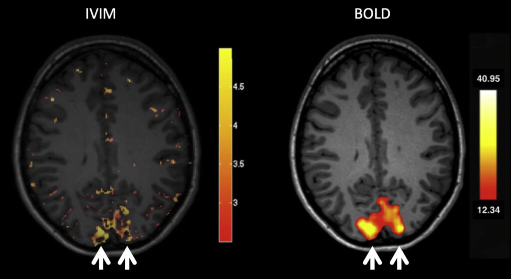 Why is IVIM Health Imaging Important